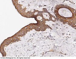Sino Biological Anti-IL-38/IL1F10 Antibody, Rabbit Polyclonal, Quantity: