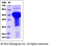 Sino Biological Recombinant Human Tau Protein (His Tag), Quantity: Each