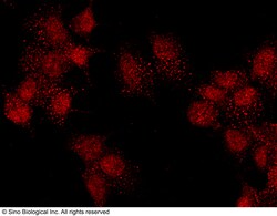 Sino Biological PBX1 Antibody, Rabbit PAb, Antigen Affinity Purified 100uL,