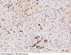 Sino Biological Anti-HLA-DR Antibody, Rabbit Polyclonal, Quantity: Each