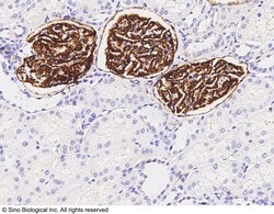 Sino Biological Anti-PODXL Antibody, Rabbit Polyclonal, Quantity: Each