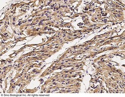 Sino Biological Anti-Cx3cr1 Antibody, Rabbit Polyclonal, Quantity: Each
