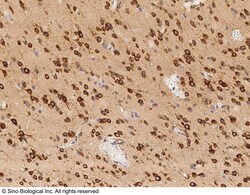 Sino Biological Anti-TLR2 Antibody, Mouse Monoclonal, Quantity: Each of