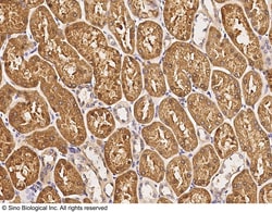 Sino Biological PUM2 Antibody, Rabbit PAb, Antigen Affinity Purified 100uL,