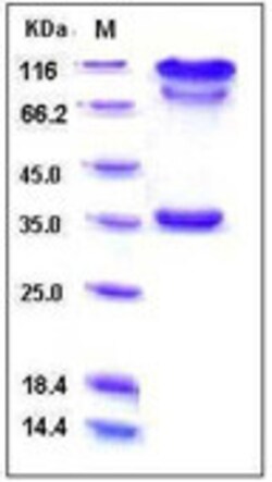 Sino Biological Human BACE1 / ASP2 Protein (Fc Tag) 100ug, Quantity: Each
