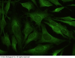 Sino Biological Recombinant Anti-BACE1 Antibody (PE), Rabbit Monoclonal,