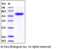 Sino Biological Human ALK-1 / ACVRL1 Protein (Fc Tag) 100ug, Quantity:
