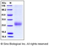 Sino Biological Recombinant Human ALK-1 Protein (His Tag), HPLC-verified,