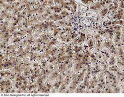 Sino Biological Anti-ALK-1 Antibody, Rabbit Polyclonal, Quantity: Each