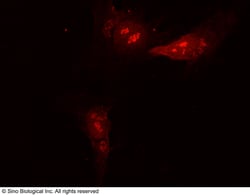 Sino Biological Anti-ATG12 Antibody, Rabbit Polyclonal, Quantity: Each