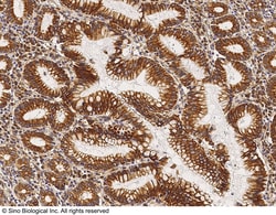 Sino Biological Anti-Cytokeratin 1/KRT1 Antibody, Rabbit Polyclonal, Quantity: