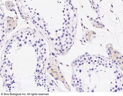 Sino Biological Anti-LY6K Antibody, Rabbit Polyclonal, Quantity: Each of