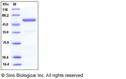 Sino Biological Recombinant Human Carboxypeptidase E/CPE Protein (His Tag),
