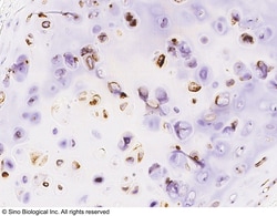 Sino Biological ACAN Antibody, Rabbit PAb, Antigen Affinity Purified 100uL,