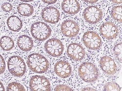 Sino Biological AGR2 Antibody, Rabbit PAb, Antigen Affinity Purified 100uL,