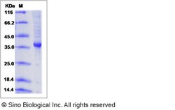 Sino Biological Recombinant Human AGRP Protein (hFc Tag), Quantity: Each