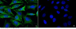 Sino Biological GRIK2 Antibody, Rabbit PAb, Antigen Affinity Purified 100uL,