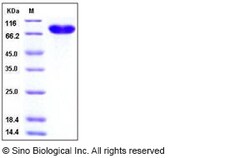 Sino Biological Recombinant Human CD14 Protein (hFc Tag), Quantity: Each