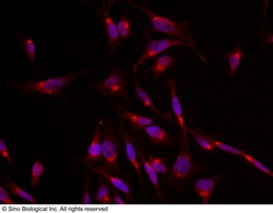 Sino Biological Anti-Glut4/SLC2A4 Antibody, Rabbit Polyclonal, Quantity: