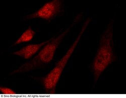 Sino Biological Anti-MuRF1/TRIM63 Antibody, Rabbit Polyclonal, Quantity: