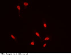 Sino Biological Anti-ZIC3 Antibody, Rabbit Polyclonal, Quantity: Each of
