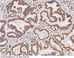 Sino Biological Anti-BMPR1A/ALK-3 Antibody, Rabbit Polyclonal, Quantity: