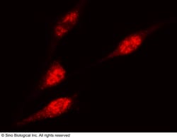 Sino Biological Anti-CAMKIV Antibody, Rabbit Polyclonal, Quantity: Each