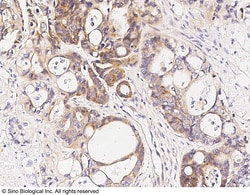 Sino Biological Anti-CAMKIV Antibody, Rabbit Polyclonal, Quantity: Each