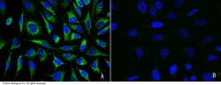 Sino Biological GOT2 Antibody, Rabbit PAb, Antigen Affinity Purified 100uL,