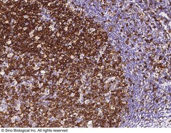 Sino Biological STMN1 / Stathmin 1 Antibody, Rabbit PAb, Antigen Affinity