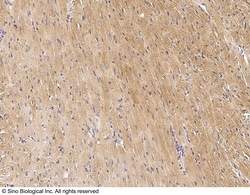 Sino Biological Anti-Cardiac Troponin I/cTnI Antibody, Rabbit Polyclonal,
