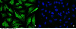 Sino Biological Anti-CBP/CREBBP Antibody, Rabbit Polyclonal, Quantity: