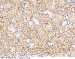 Sino Biological Anti-SIRT3 Antibody, Rabbit Polyclonal, Quantity: Each