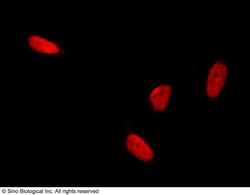 Sino Biological Anti-HP1 Gamma/CBX3 Antibody, Rabbit Polyclonal, Quantity: