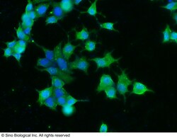 Sino Biological CNDP1 Antibody, Rabbit MAb 100uL, Quantity: Each of 1