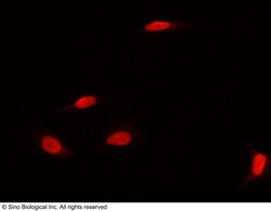Sino Biological DNMT1 Antibody, Rabbit PAb, Antigen Affinity Purified 100uL,