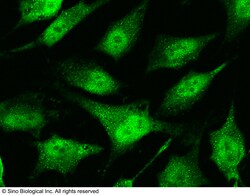 Sino Biological Anti-BAX Antibody, Rabbit Polyclonal, Quantity: Each of