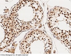 Sino Biological Anti-HDAC11 Antibody, Rabbit Polyclonal, Quantity: Each