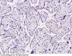 Sino Biological Anti-CDK2 Antibody, Rabbit Polyclonal, Quantity: Each of