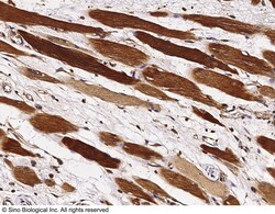 Sino Biological Anti-p38 Antibody, Rabbit Polyclonal, Quantity: Each of