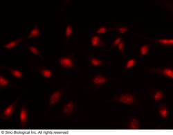 Sino Biological Anti-BCOR Antibody, Rabbit Polyclonal, Quantity: Each of
