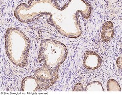 Sino Biological ASB2 Antibody, Rabbit PAb, Antigen Affinity Purified 100uL,