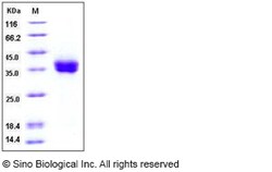 Sino Biological Human PD-L1 / B7-H1 / CD274 Protein (His Tag) 100ug, Quantity: