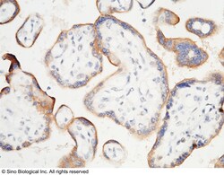 Sino Biological Recombinant Anti-PD-L1/B7-H1 Antibody, Rabbit Monoclonal,