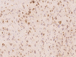 Sino Biological ALK-6 / BMPR1B Antibody, Rabbit PAb, Antigen Affinity Purified