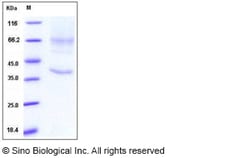 Sino Biological Recombinant Human Glypican 3/GPC3 Protein (His Tag), HPLC-verified,