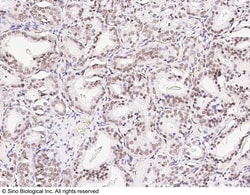 Sino Biological Anti-CREB Antibody, Rabbit Polyclonal, Quantity: Each of