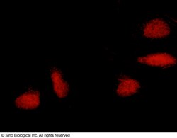 Sino Biological ERCC8 / CSA Antibody, Rabbit PAb, Antigen Affinity Purified
