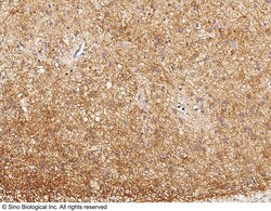 Sino Biological Anti-DPM1 Antibody, Rabbit Polyclonal, Quantity: Each of