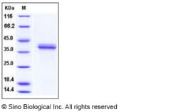 Sino Biological Recombinant Human Cathepsin V Protein (His Tag), HPLC-verified,